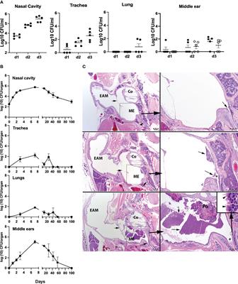 Probing Immune-Mediated Clearance of Acute Middle Ear Infection in Mice